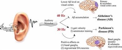 Perspectives of Circadian-Based Music Therapy for the Pathogenesis and Symptomatic Treatment of Neurodegenerative Disorders